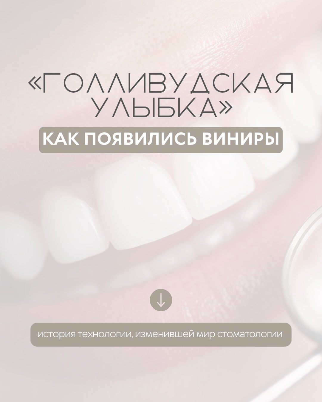 Виниры — фото 1, клиника TopStom