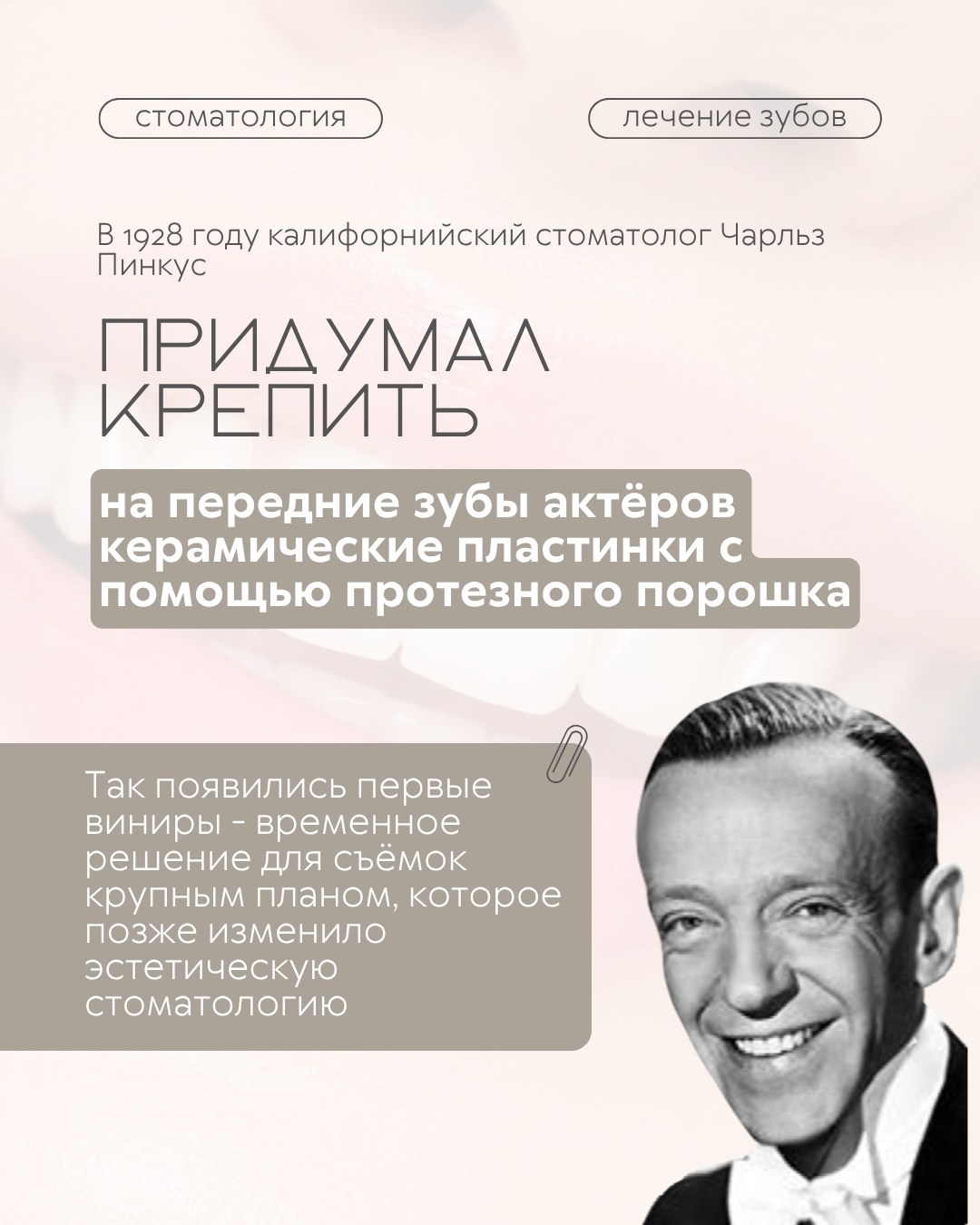 Виниры — фото 2, клиника TopStom
