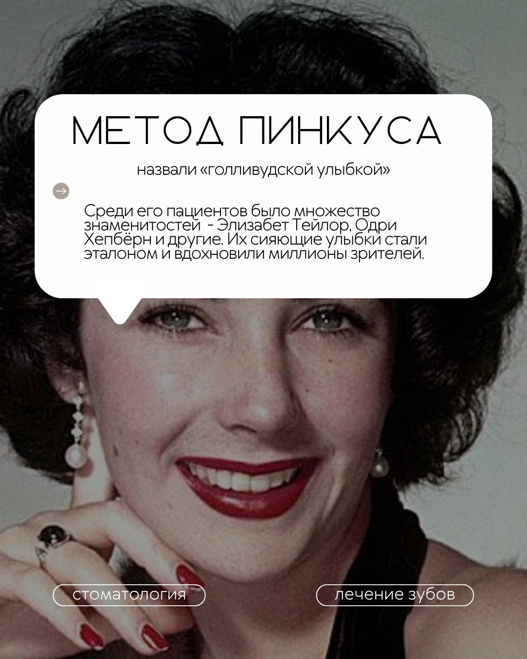 Виниры — фото 4, клиника TopStom