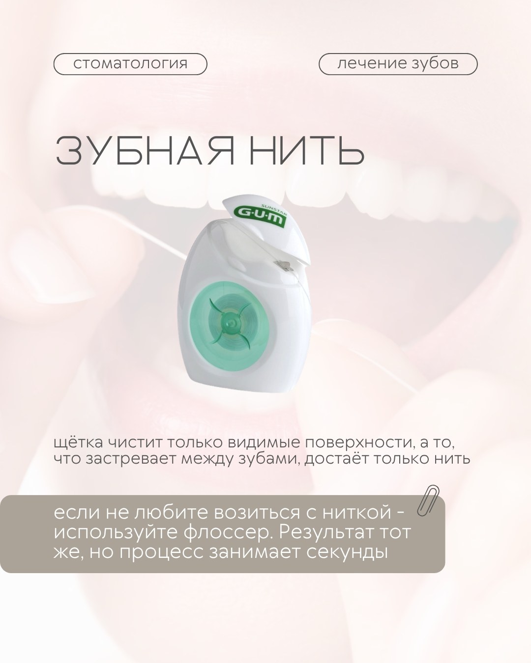 Профилактика и гигиена — фото 3, клиника TopStom