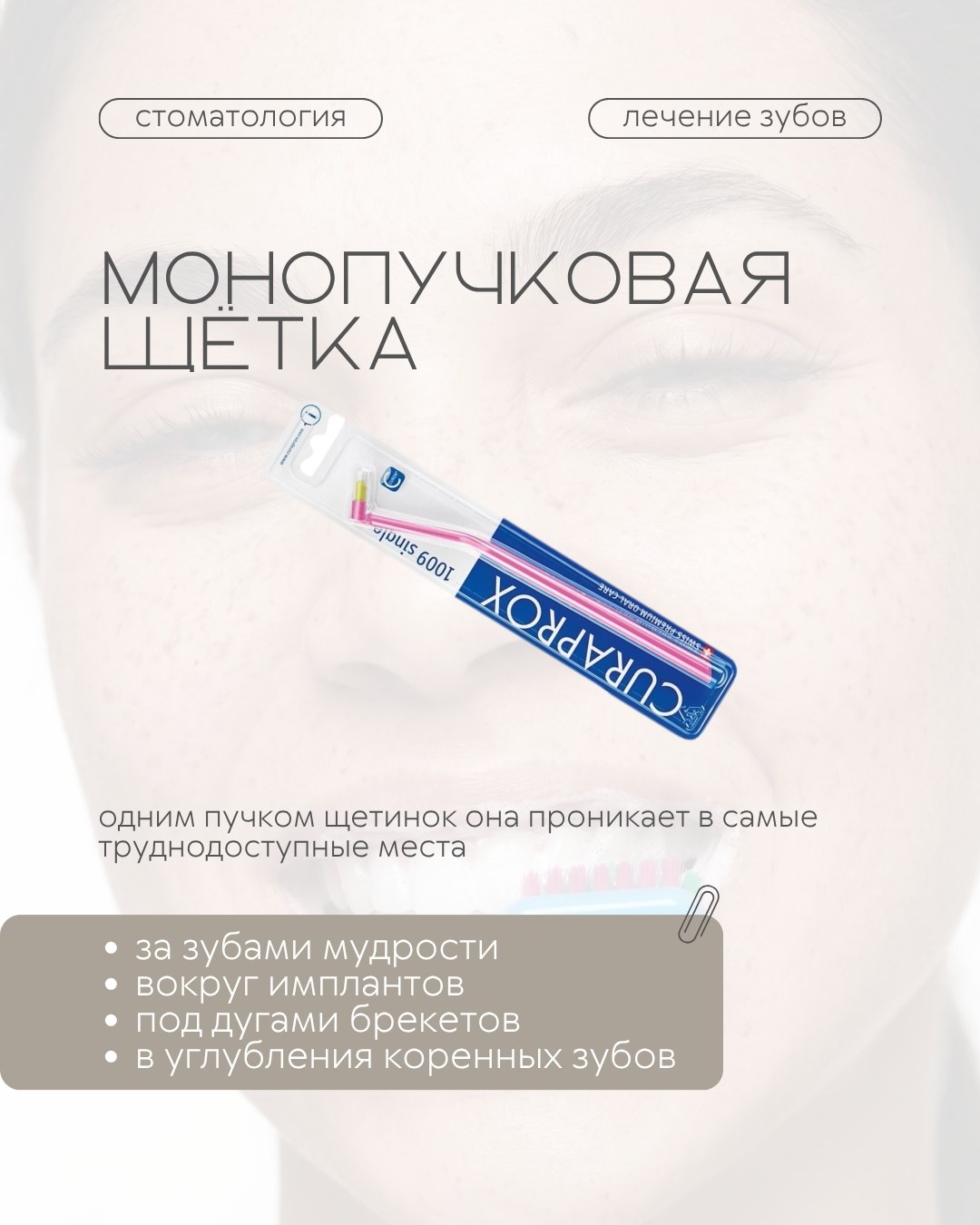 Профилактика и гигиена — фото 4, клиника TopStom