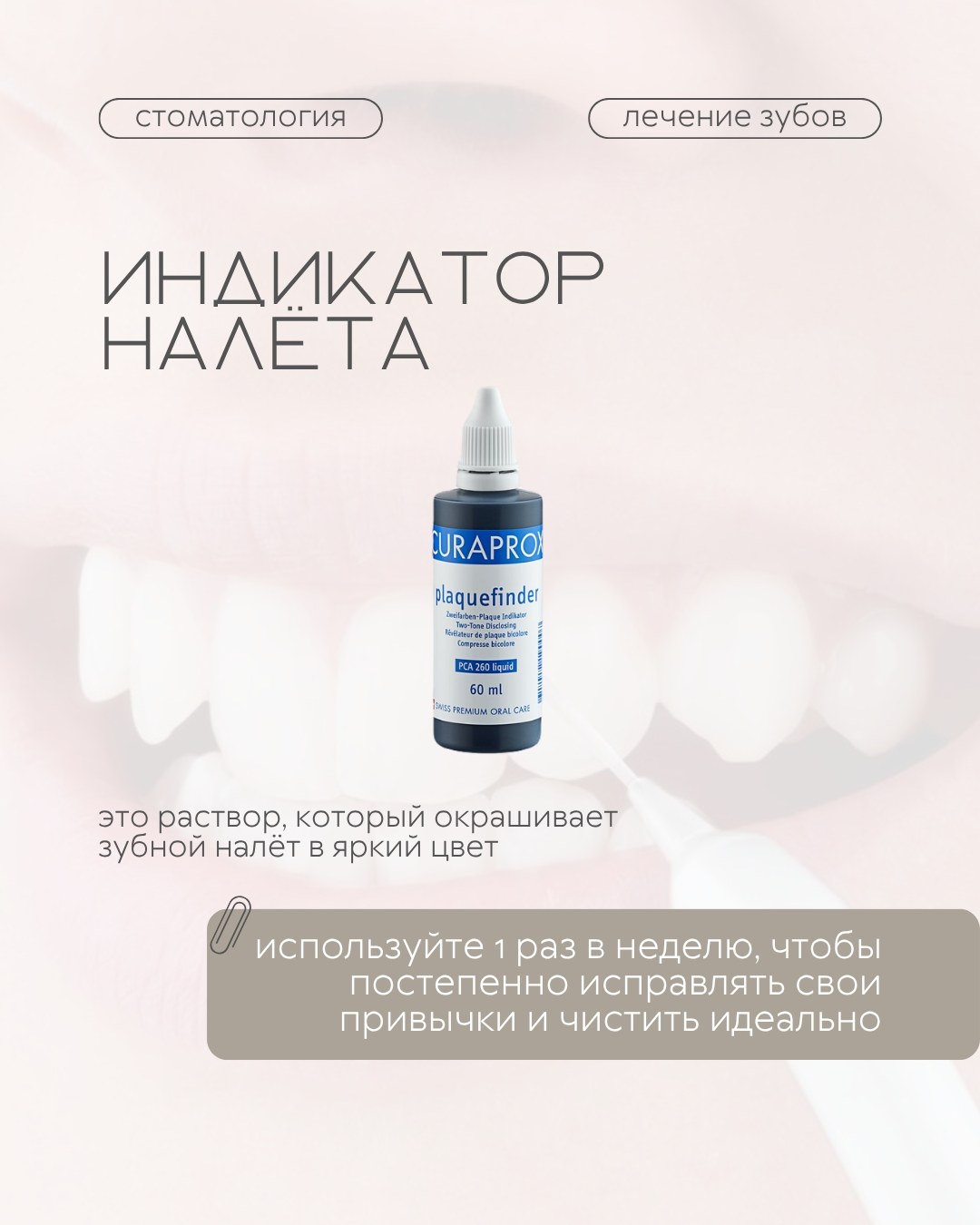 Профилактика и гигиена — фото 5, клиника TopStom