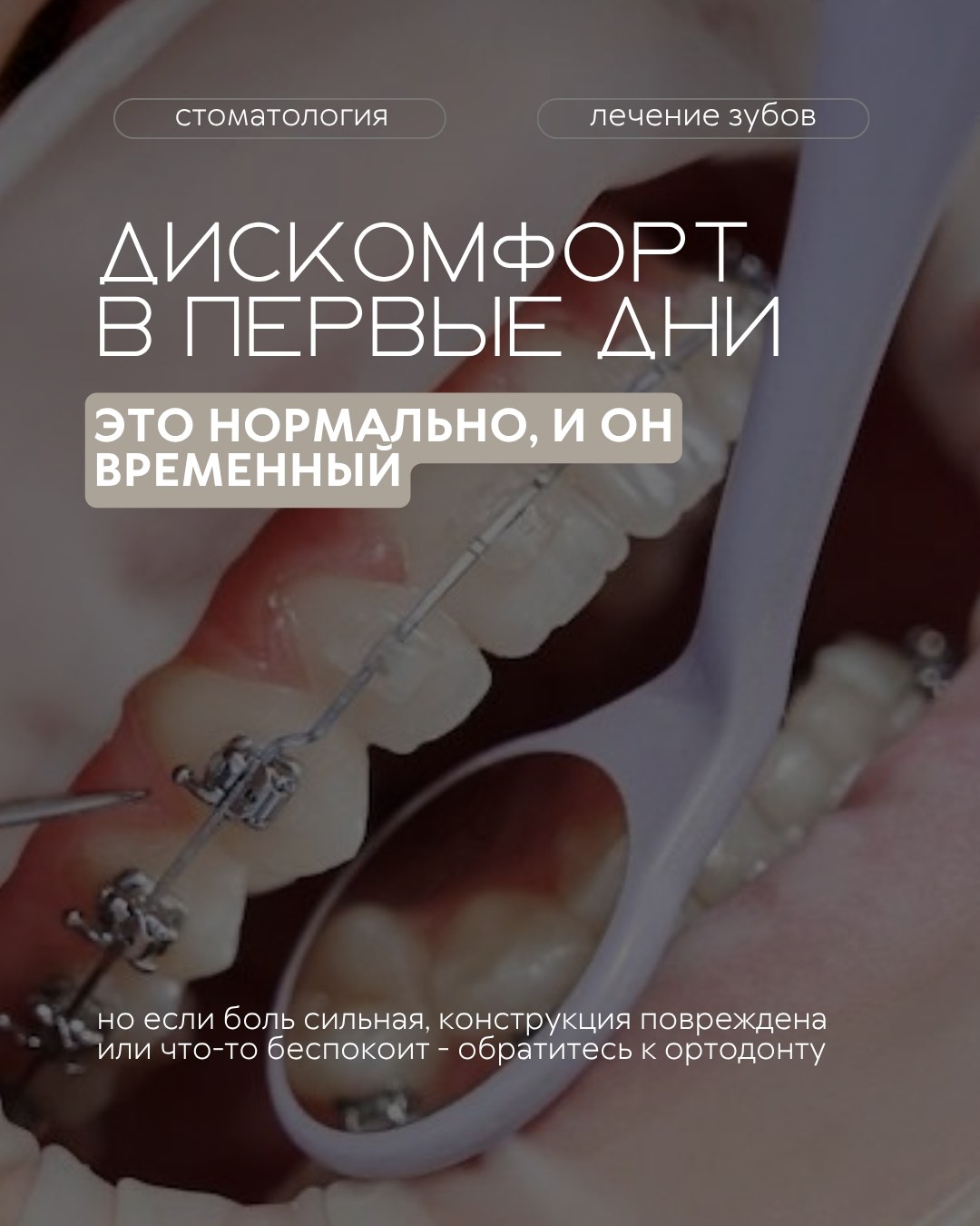 Брекеты и элайнеры — фото 6, клиника TopStom