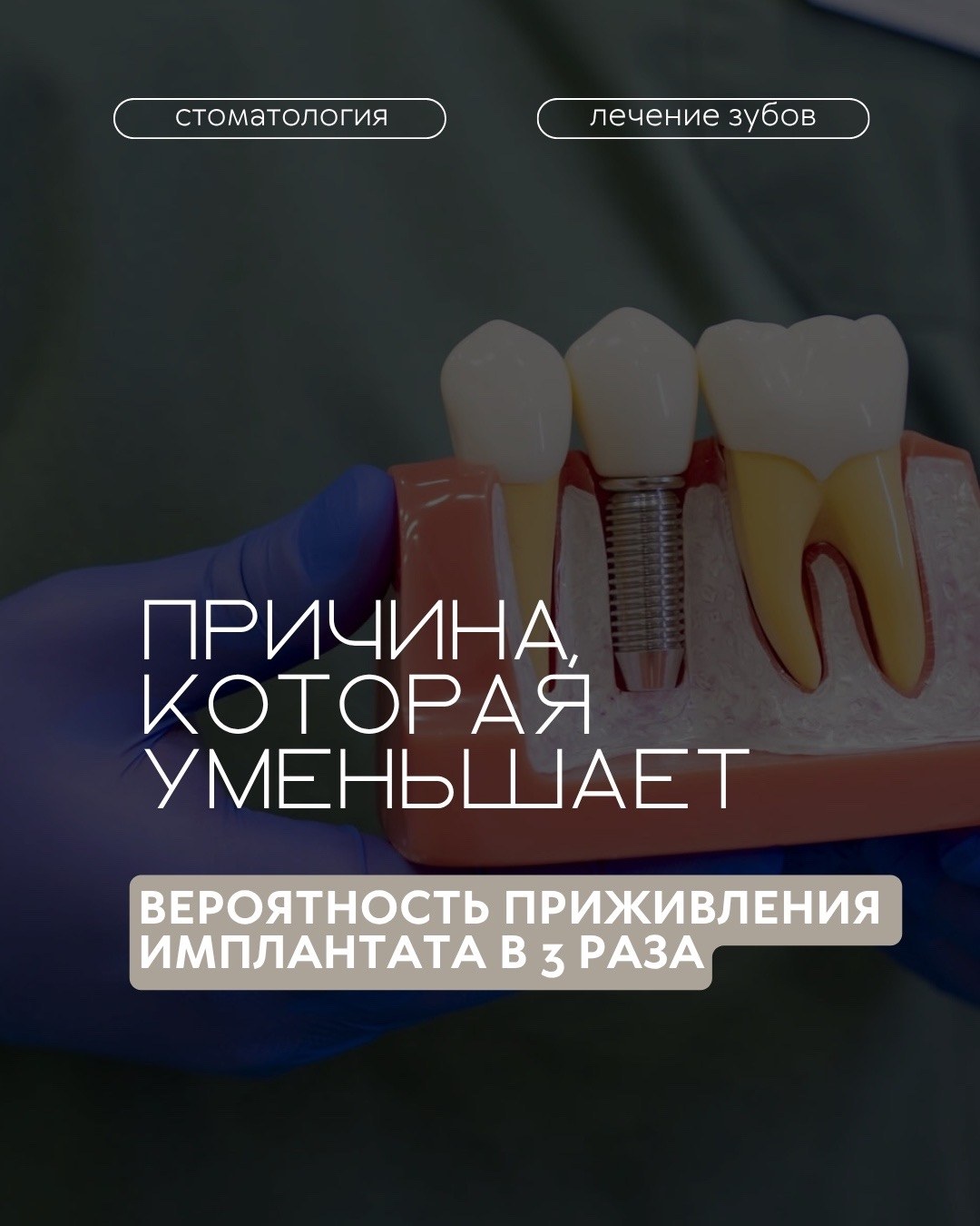 Имплантация зубов — фото 1, клиника TopStom
