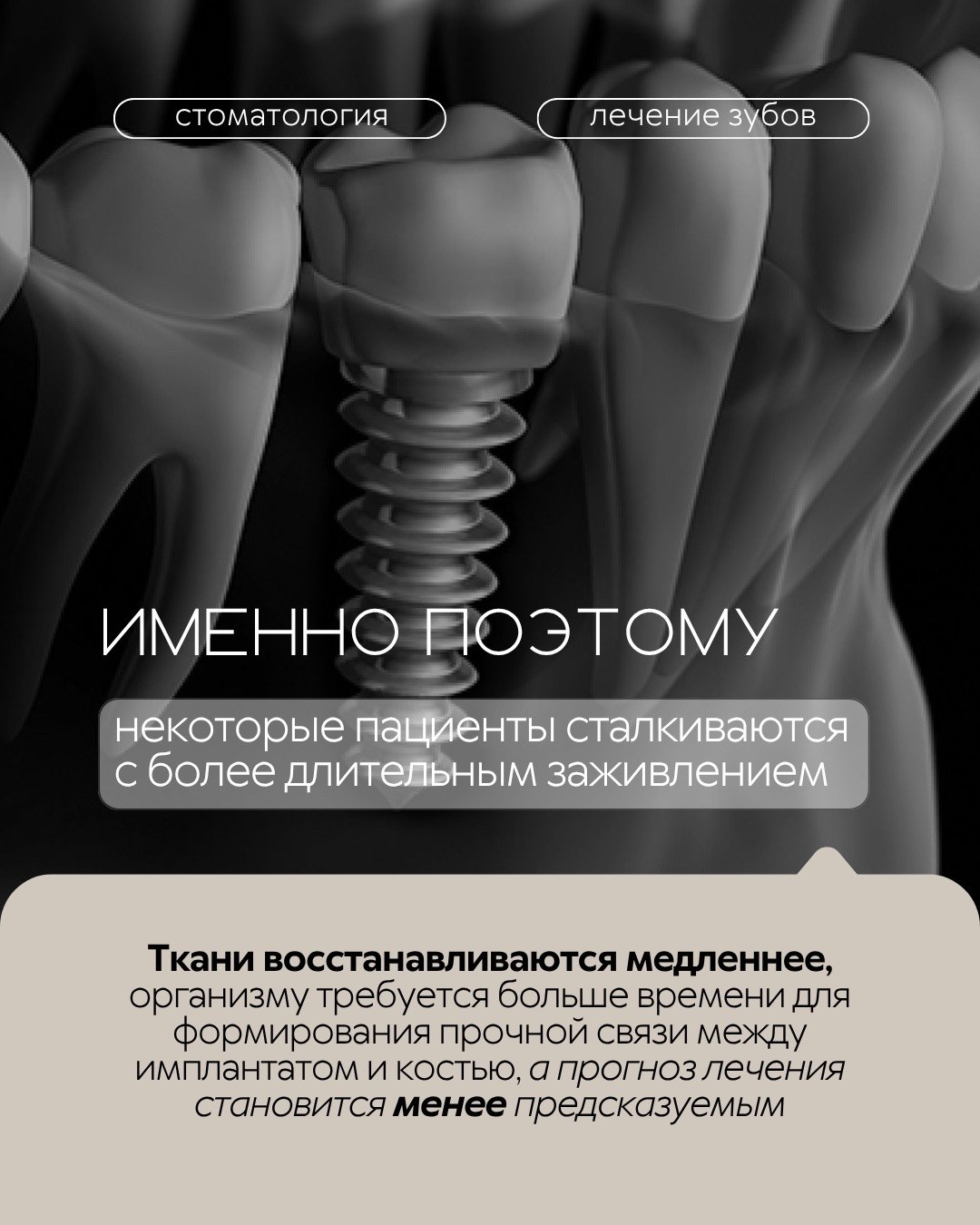 Имплантация зубов — фото 3, клиника TopStom