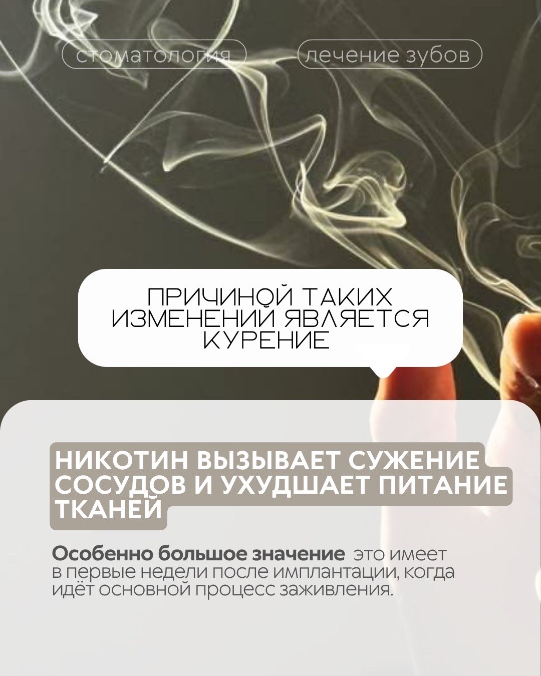 Имплантация зубов — фото 4, клиника TopStom