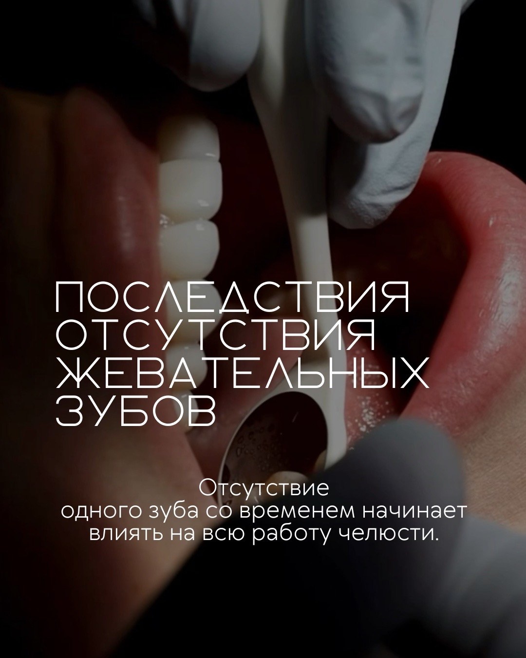 Имплантация зубов — фото 1, клиника TopStom