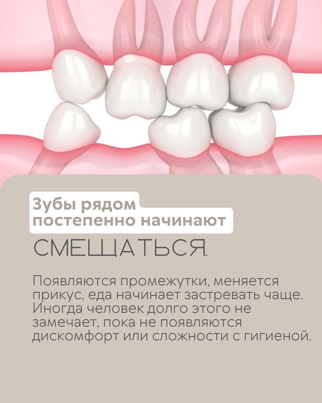 Имплантация зубов — фото 3, клиника TopStom