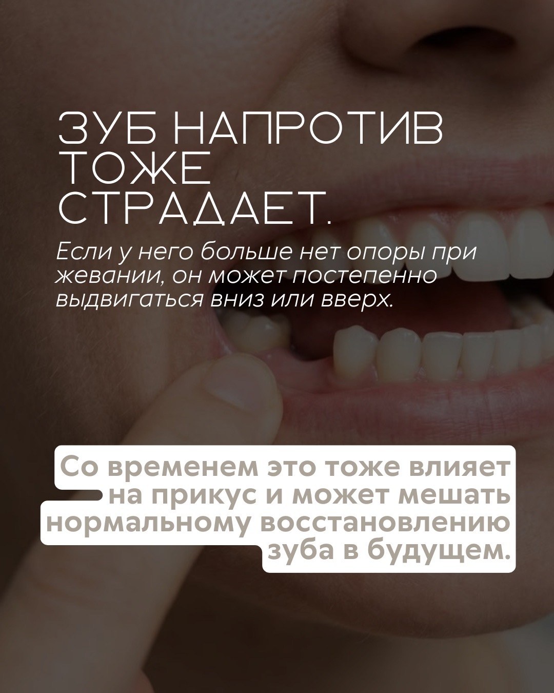 Имплантация зубов — фото 4, клиника TopStom