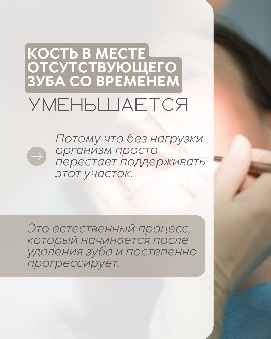 Имплантация зубов — фото 5, клиника TopStom