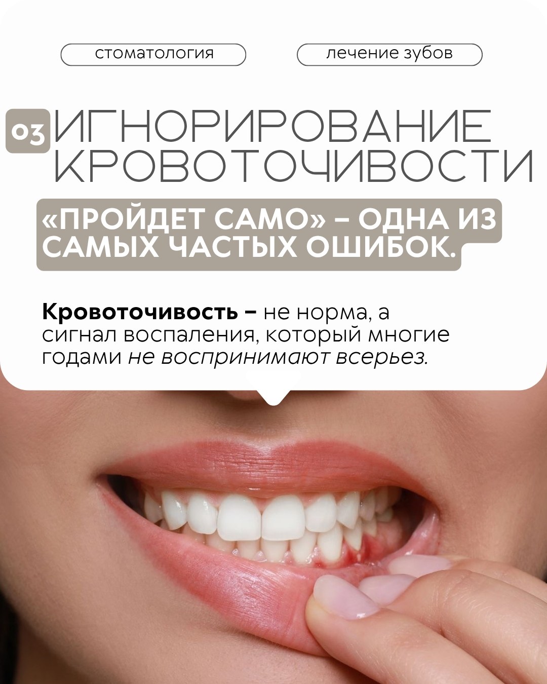 Профилактика и гигиена — фото 4, клиника TopStom