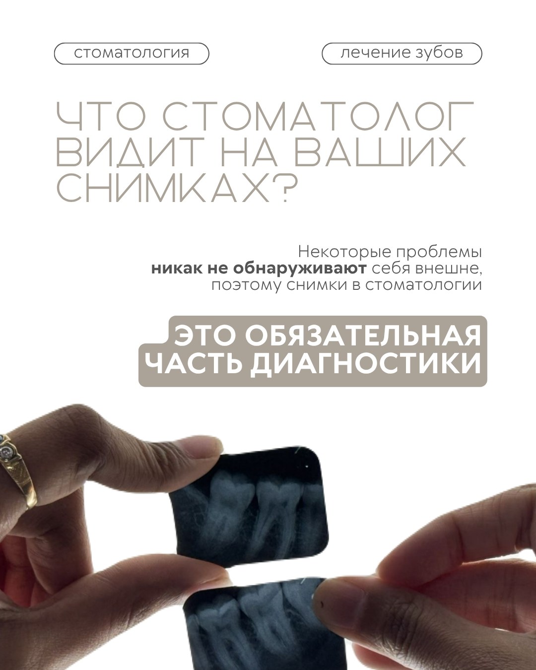 Лечение зубов — фото 1, клиника TopStom