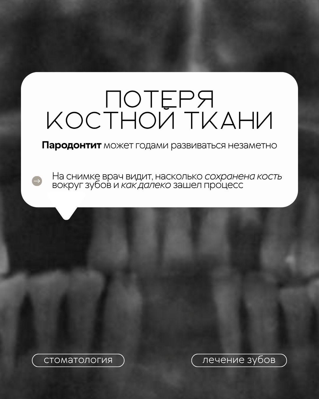 Лечение зубов — фото 3, клиника TopStom