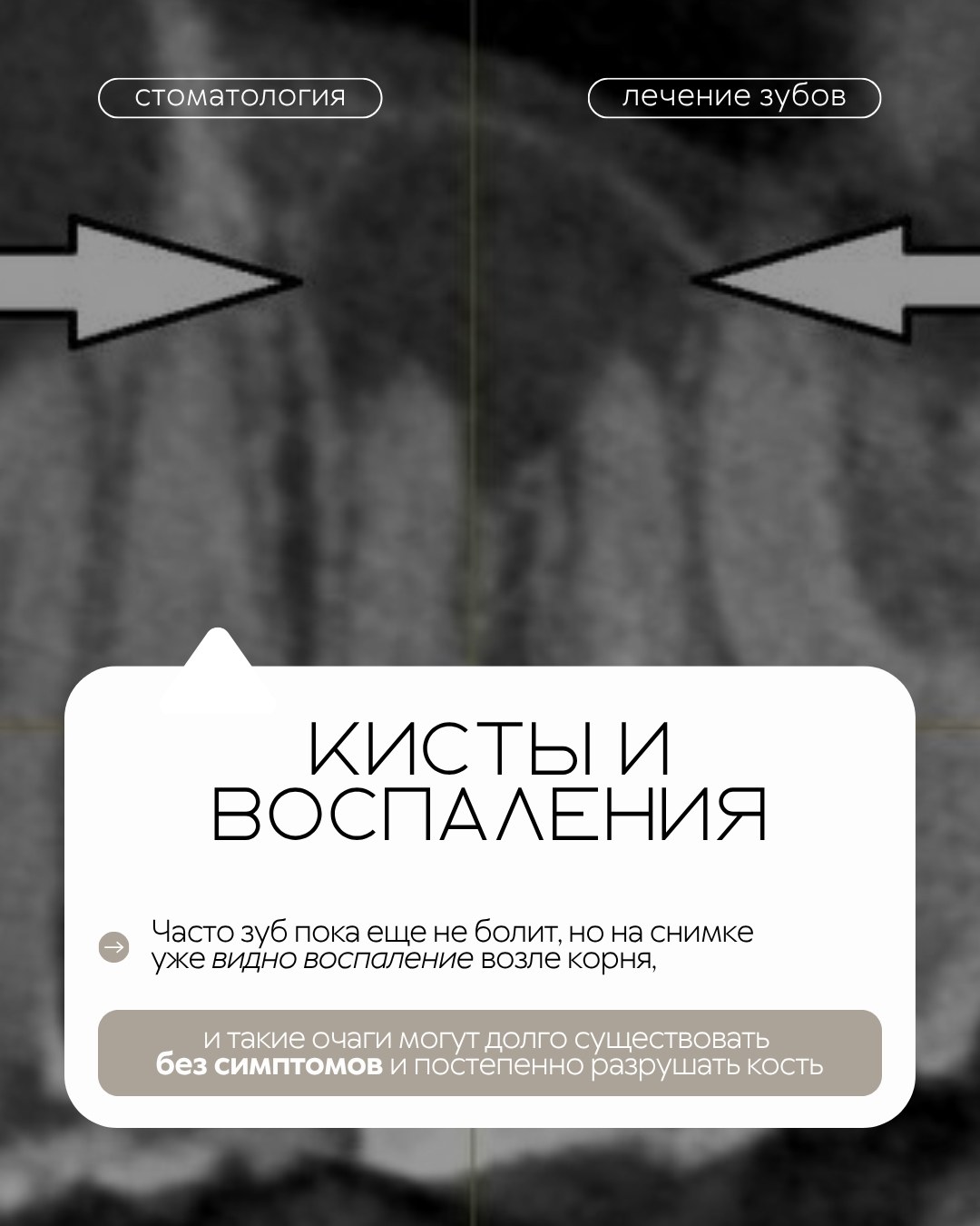 Лечение зубов — фото 4, клиника TopStom