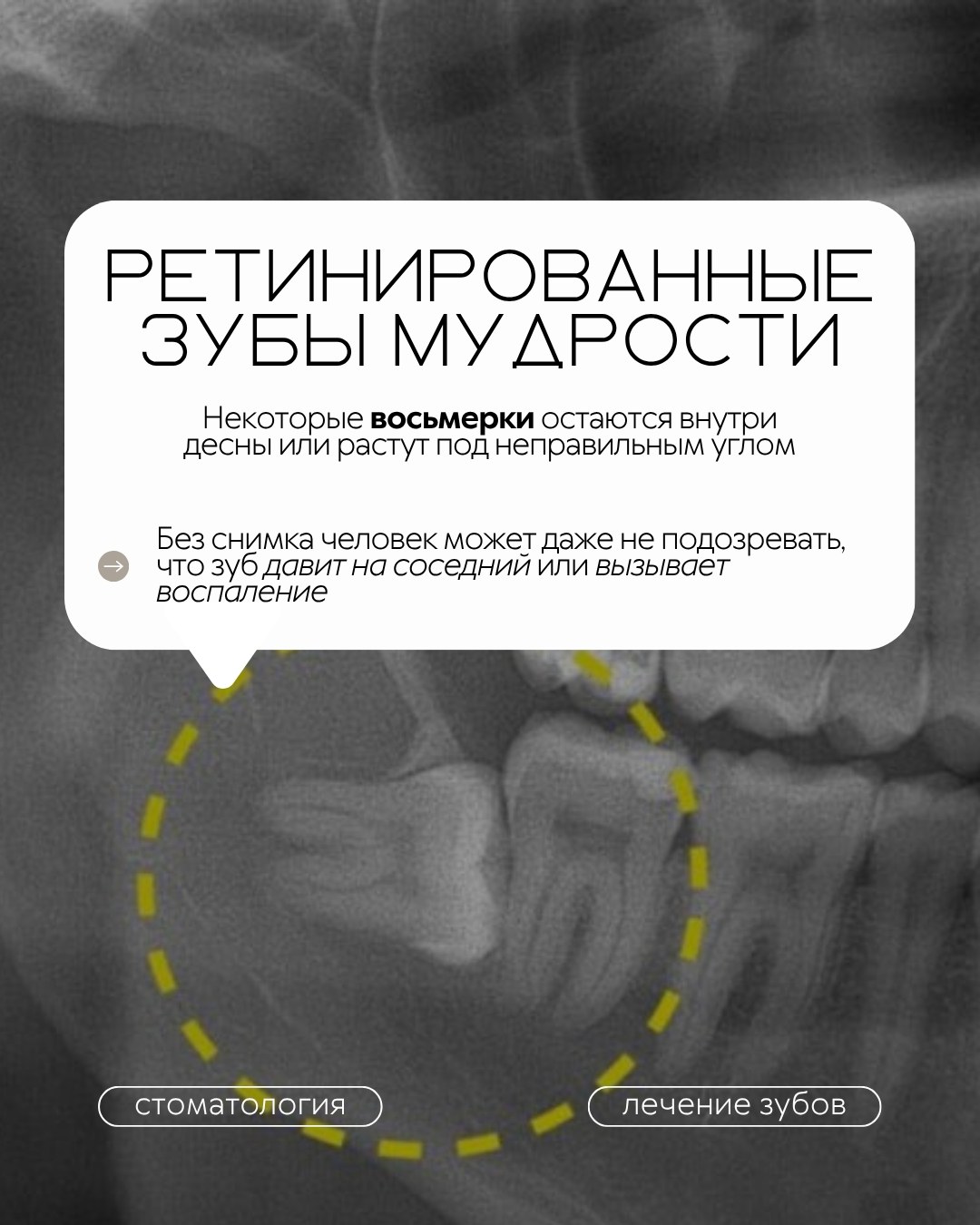 Лечение зубов — фото 5, клиника TopStom