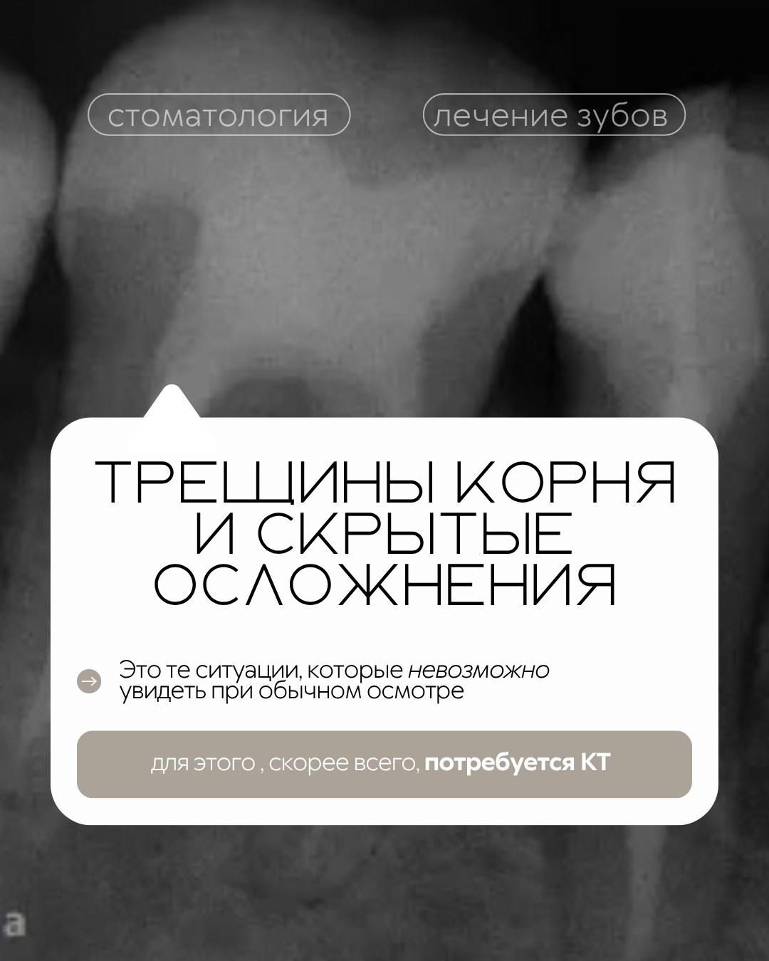 Лечение зубов — фото 6, клиника TopStom